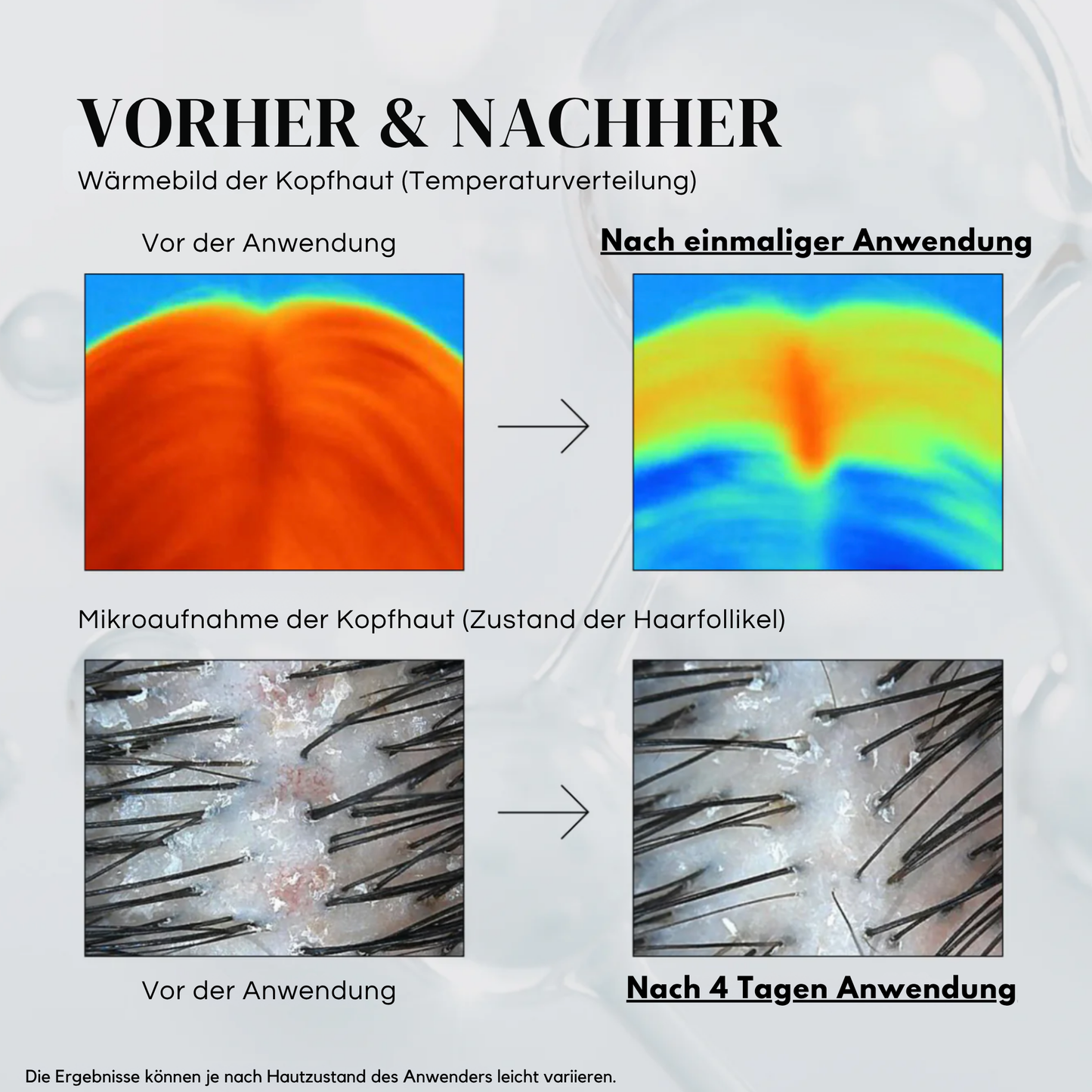 Haarwachstums Booster mit PDRN 15ml