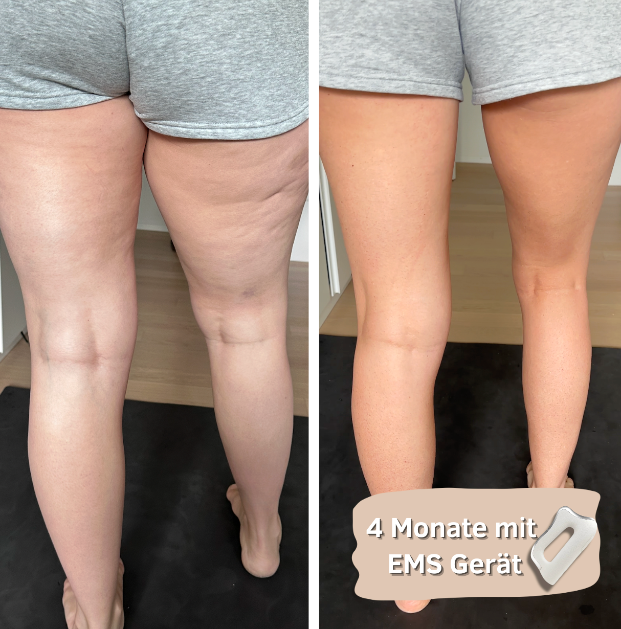 Bye Bye Cellulite - EMS Beauty Gerät mit Wärme
