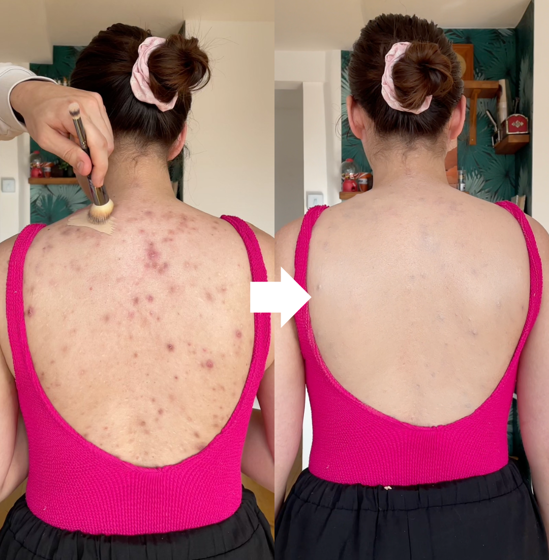 Body Foundation