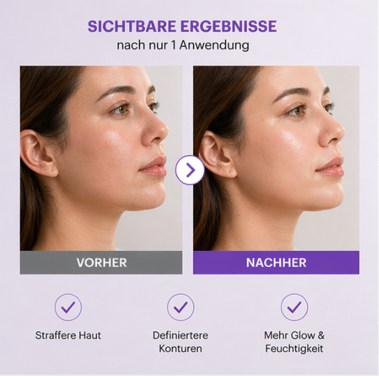 No.9 NAD+ Lifting Mask - 4 Stück