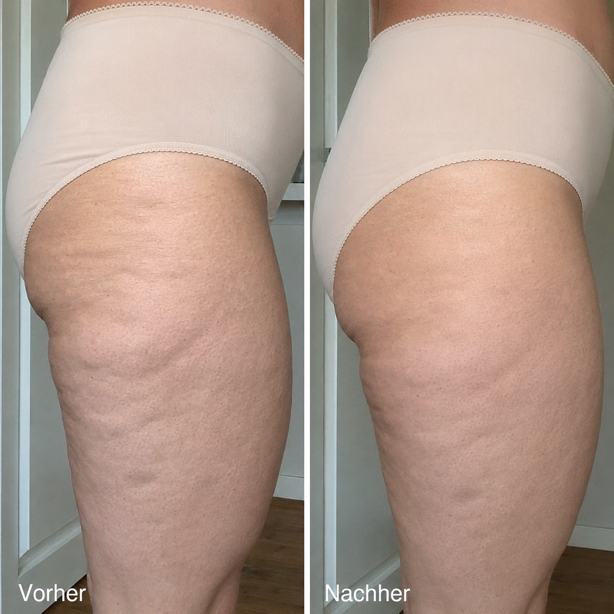 BodySmooth Pro