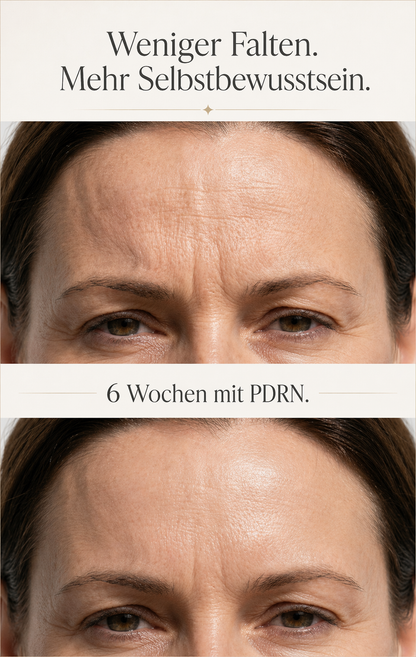PDRN Vitamin Glow Boosting Ampoule