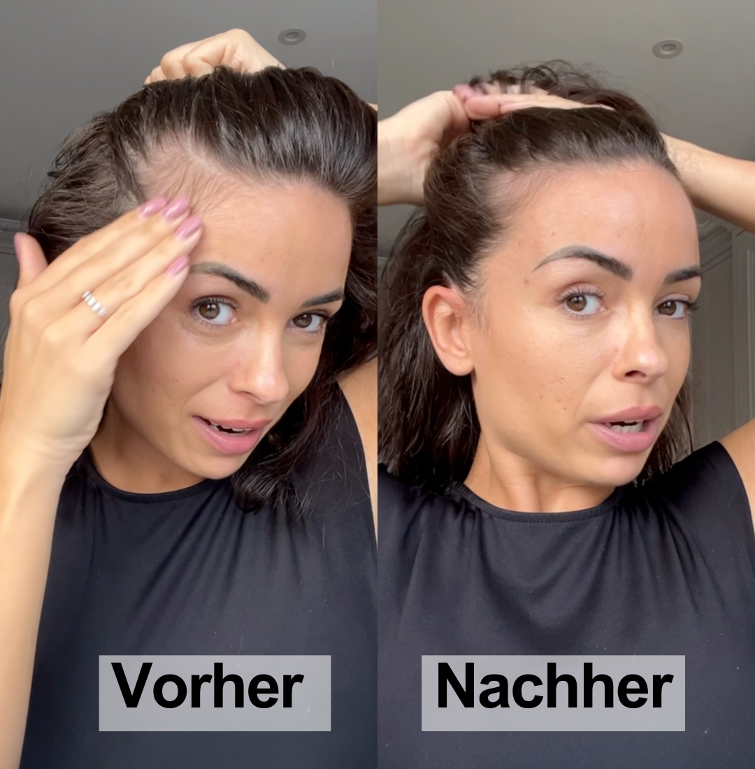 Haarwachstums Booster mit PDRN 15ml