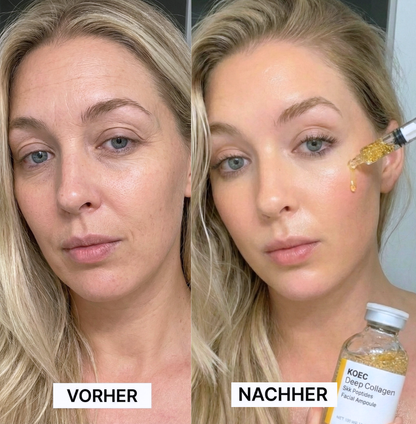 Gold SilkPeptide Lift