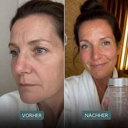 Hyaluron PDRN Orb Serum