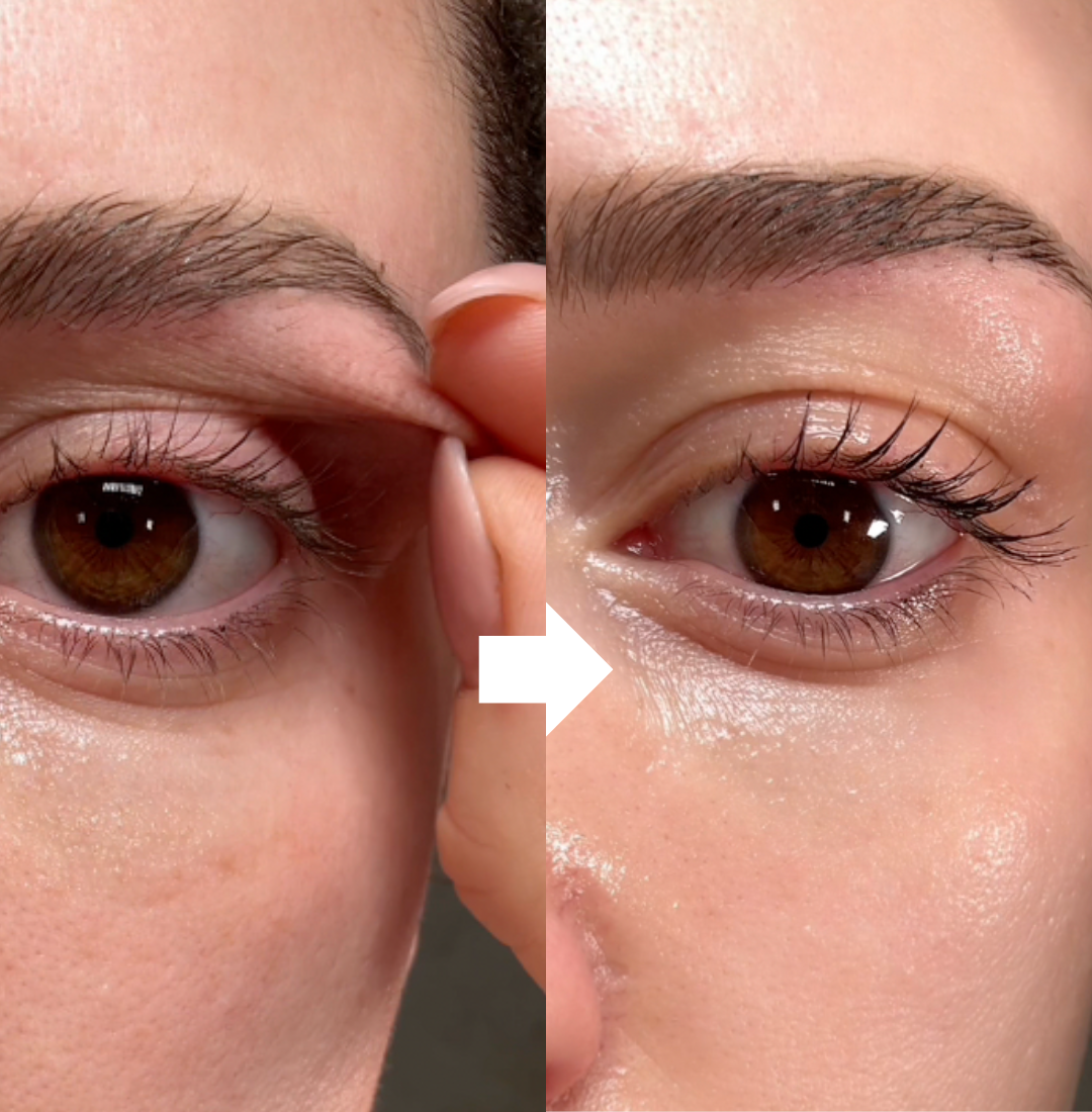 NAD+Retinol+Peptide Augencreme