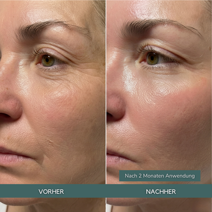 Hyaluron PDRN Orb Serum